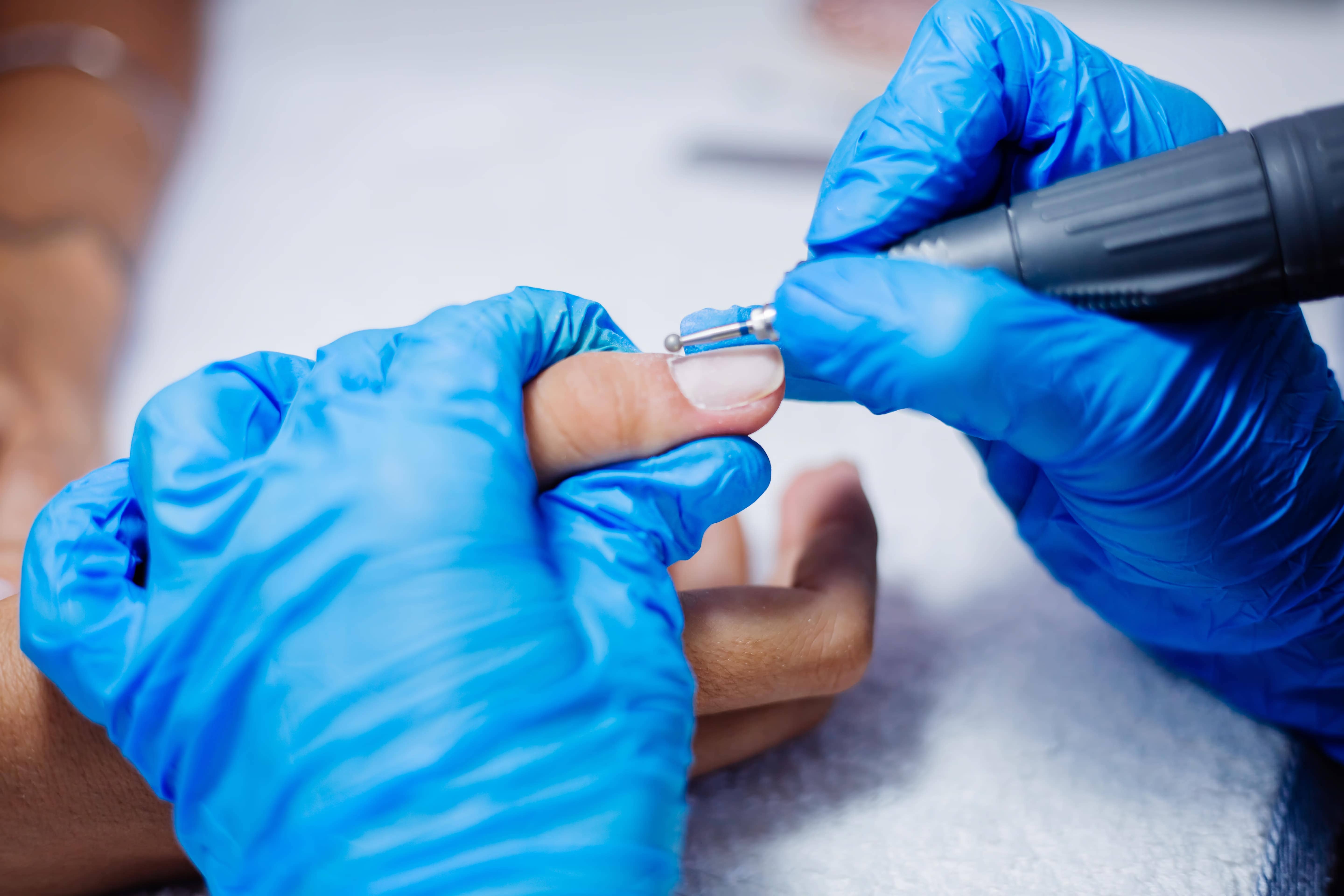 Nail disorders and nail surgery treatment