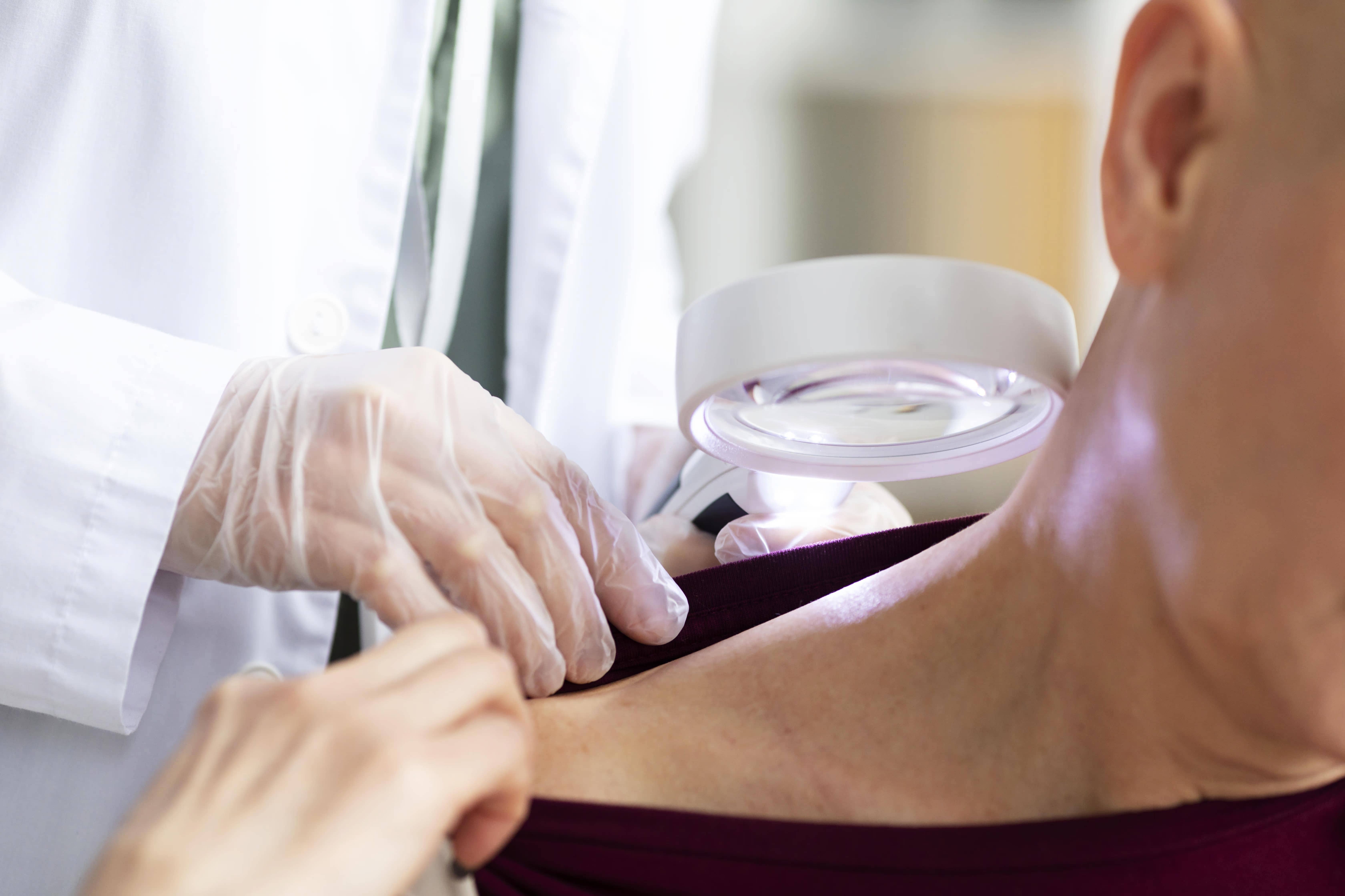 Venereology treatment