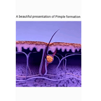 Instagram post about hair