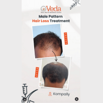 Instagram post about hair treatment