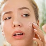 Skin Biopsy skin desize 
