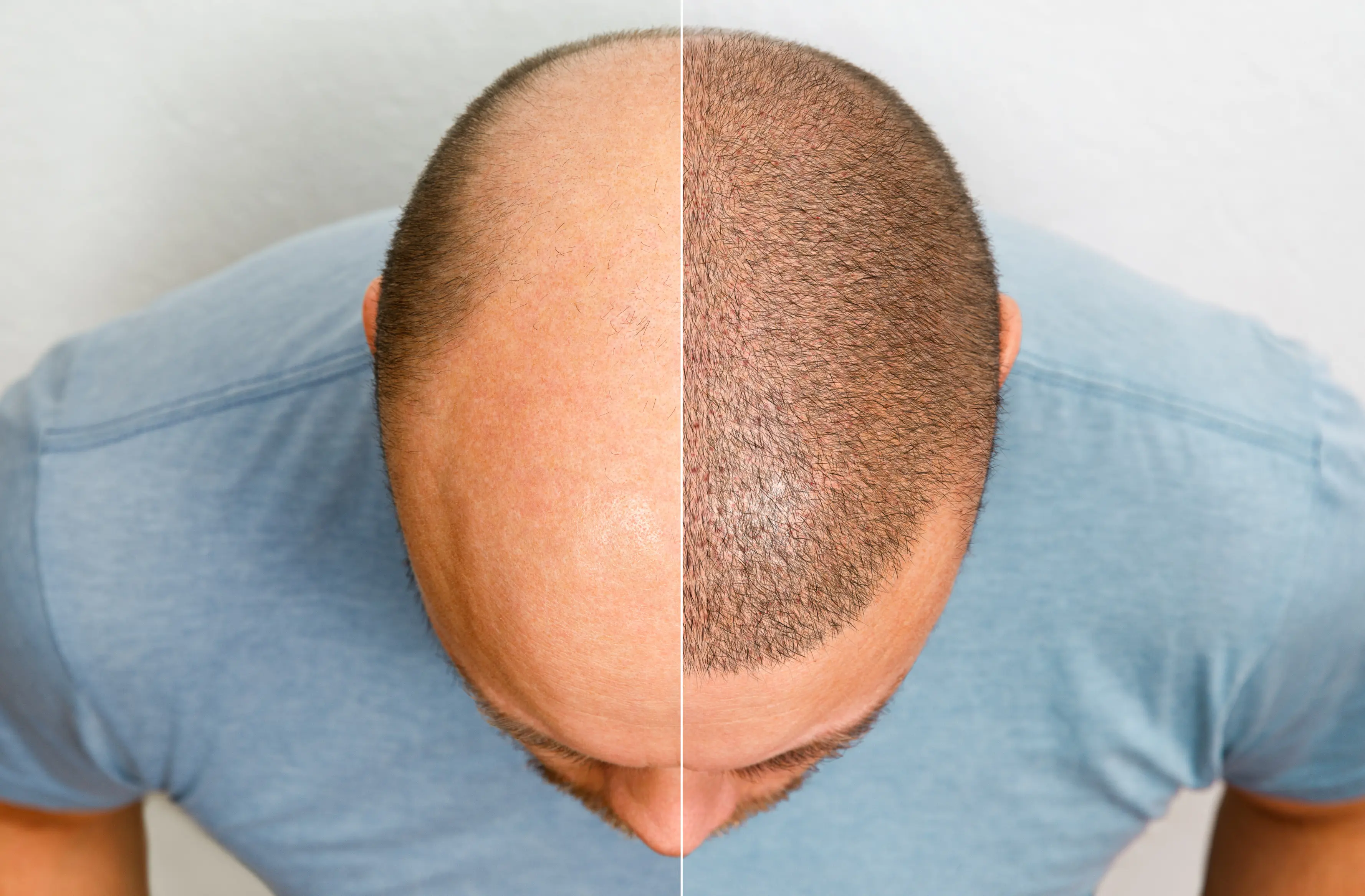 Skin Cancer Awareness: A Guide to Detecting